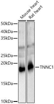 TNNC1 Rabbit Polyclonal Antibody