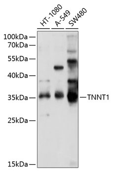 TNNT1 Rabbit Polyclonal Antibody