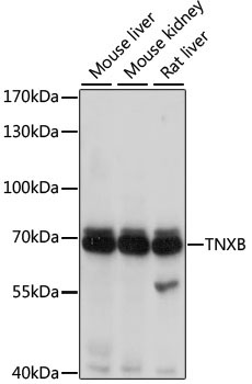 TNXB Rabbit Polyclonal Antibody