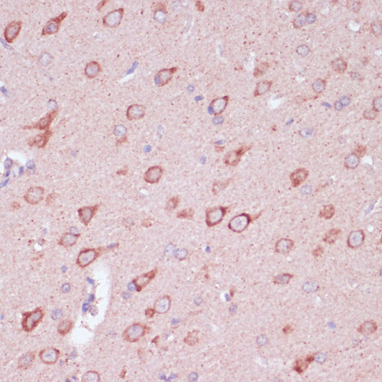 TOLLIP Rabbit Polyclonal Antibody - Image 2