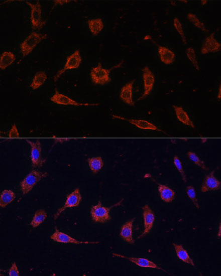 TOLLIP Rabbit Polyclonal Antibody - Image 3