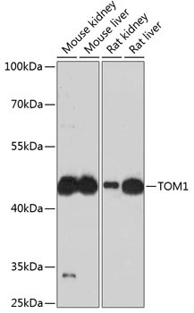 TOM1 Rabbit Polyclonal Antibody