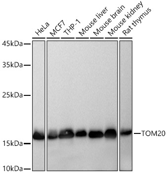 TOM20 Rabbit Monoclonal Antibody