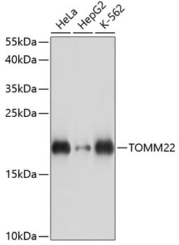 TOMM22 Rabbit Polyclonal Antibody