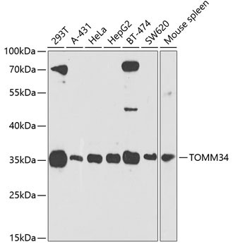 TOMM34 Rabbit Polyclonal Antibody