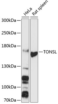 TONSL Rabbit Polyclonal Antibody