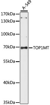 TOP1MT Rabbit Polyclonal Antibody