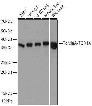 TorsinA/TOR1A Rabbit Monoclonal Antibody