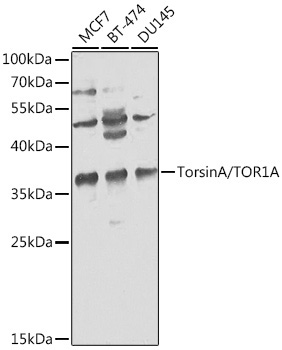 TorsinA/TOR1A Rabbit Polyclonal Antibody