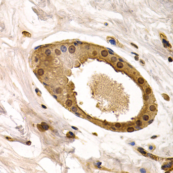 TorsinA/TOR1A Rabbit Polyclonal Antibody - Image 2