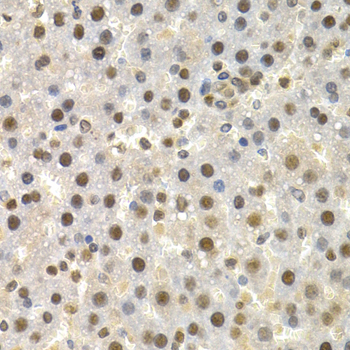 TorsinA/TOR1A Rabbit Polyclonal Antibody - Image 3