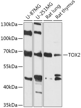 TOX2 Rabbit Polyclonal Antibody