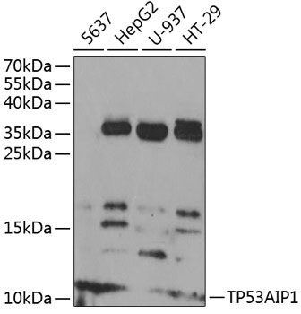 TP53AIP1 Rabbit Polyclonal Antibody