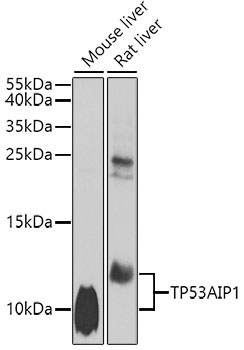 TP53AIP1 Rabbit Polyclonal Antibody