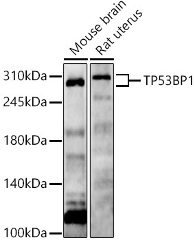 TP53BP1 Rabbit Polyclonal Antibody