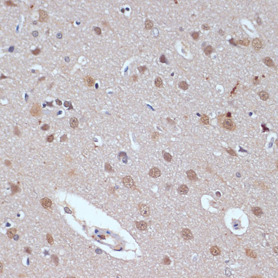 TP53BP2 Rabbit Polyclonal Antibody