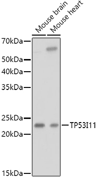 TP53I11 Rabbit Polyclonal Antibody