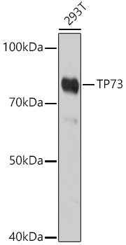 TP73 Rabbit Polyclonal Antibody
