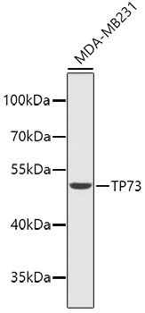 TP73 Rabbit Polyclonal Antibody