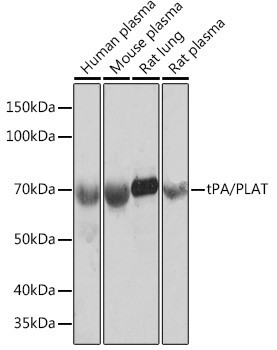 tPA/PLAT Rabbit Monoclonal Antibody
