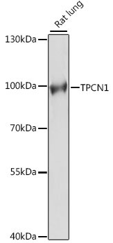 TPCN1 Rabbit Polyclonal Antibody