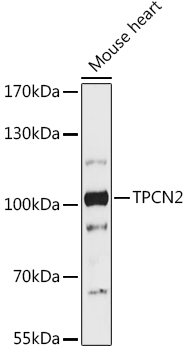 TPCN2 Rabbit Polyclonal Antibody