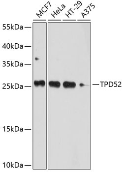 TPD52 Rabbit Polyclonal Antibody