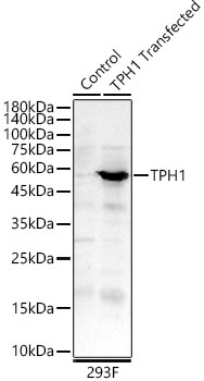 TPH1 Rabbit Polyclonal Antibody