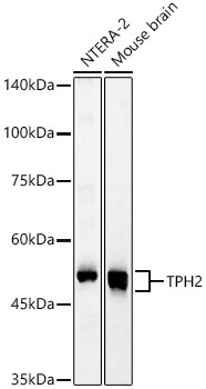 TPH2 Rabbit Polyclonal Antibody