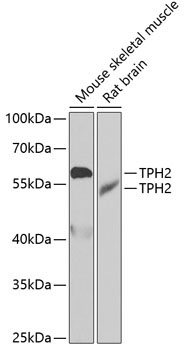 TPH2 Rabbit Polyclonal Antibody