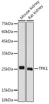 TPK1 Rabbit Polyclonal Antibody