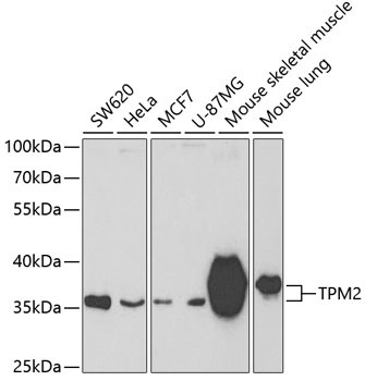 TPM2 Rabbit Polyclonal Antibody