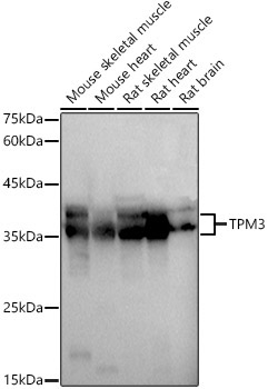 TPM3 Rabbit Polyclonal Antibody