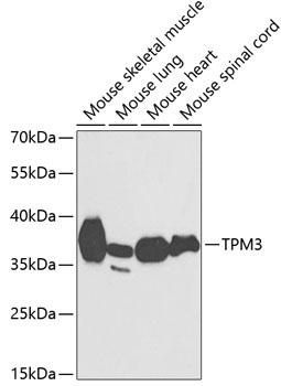TPM3 Rabbit Polyclonal Antibody
