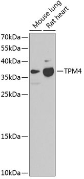 TPM4 Rabbit Polyclonal Antibody