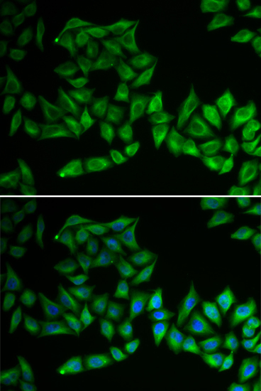 TPMT Rabbit Polyclonal Antibody