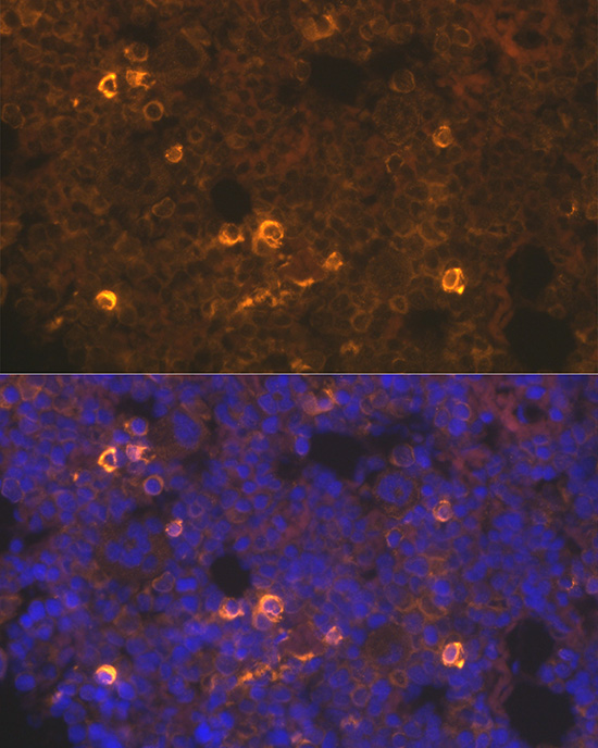 TPO-R/CD110/c-Mpl Rabbit Polyclonal Antibody - Image 2