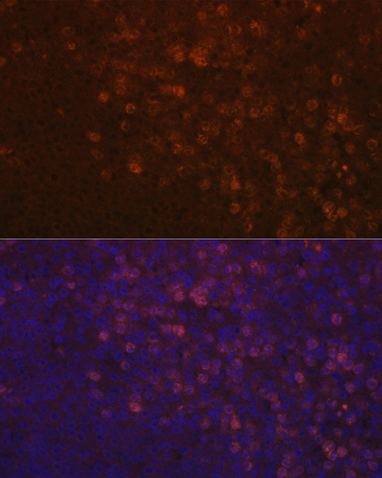 TPO-R/CD110/c-Mpl Rabbit Polyclonal Antibody - Image 3