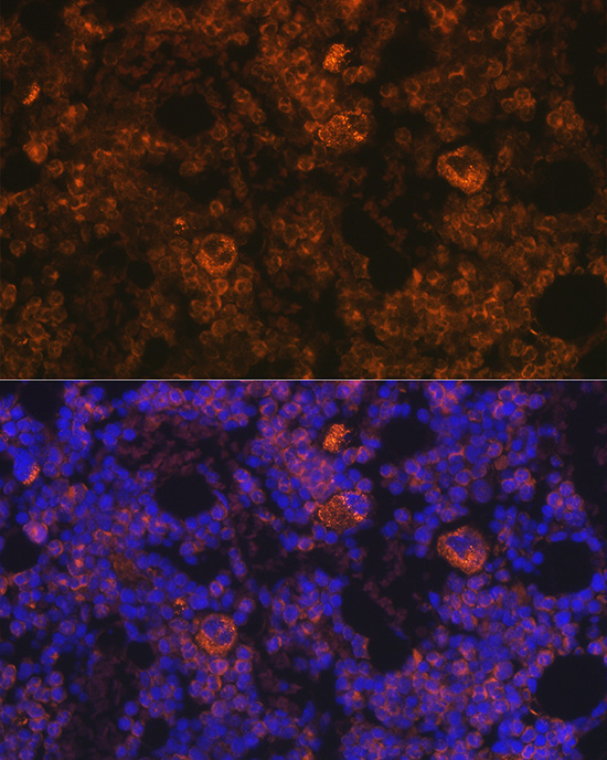 TPO-R/CD110/c-Mpl Rabbit Polyclonal Antibody - Image 4