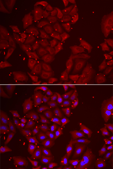 TPP2 Rabbit Polyclonal Antibody - Image 2