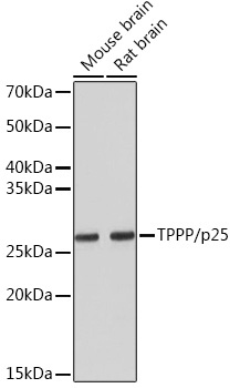 TPPP/p25 Rabbit Monoclonal Antibody