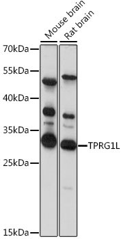 TPRG1L Rabbit Polyclonal Antibody