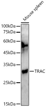 TRAC Rabbit Polyclonal Antibody