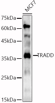 TRADD Rabbit Polyclonal Antibody