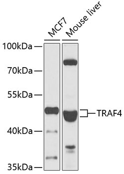 TRAF4 Rabbit Polyclonal Antibody