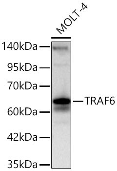 TRAF6 Rabbit Polyclonal Antibody