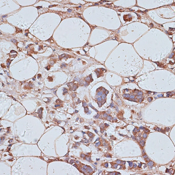 TRAF6BP/TAX1BP1 Rabbit Polyclonal Antibody - Image 2
