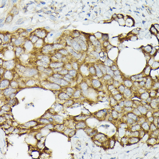 TRAF7 Rabbit Polyclonal Antibody - Image 2