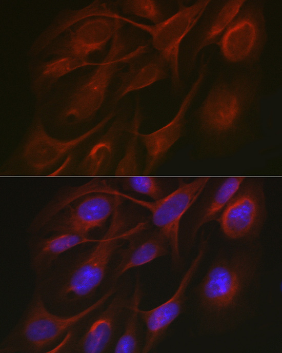 TRAF7 Rabbit Polyclonal Antibody - Image 3