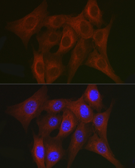 TRAF7 Rabbit Polyclonal Antibody - Image 4